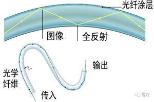 亳州内窥镜软管人流(内窥镜流产手术需要多少钱)